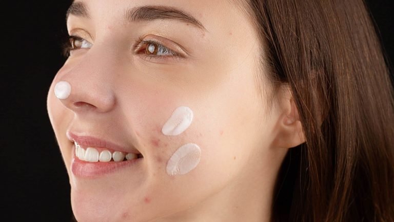 5 Best Face Cream For Treating Acne Pimples And Blackhead